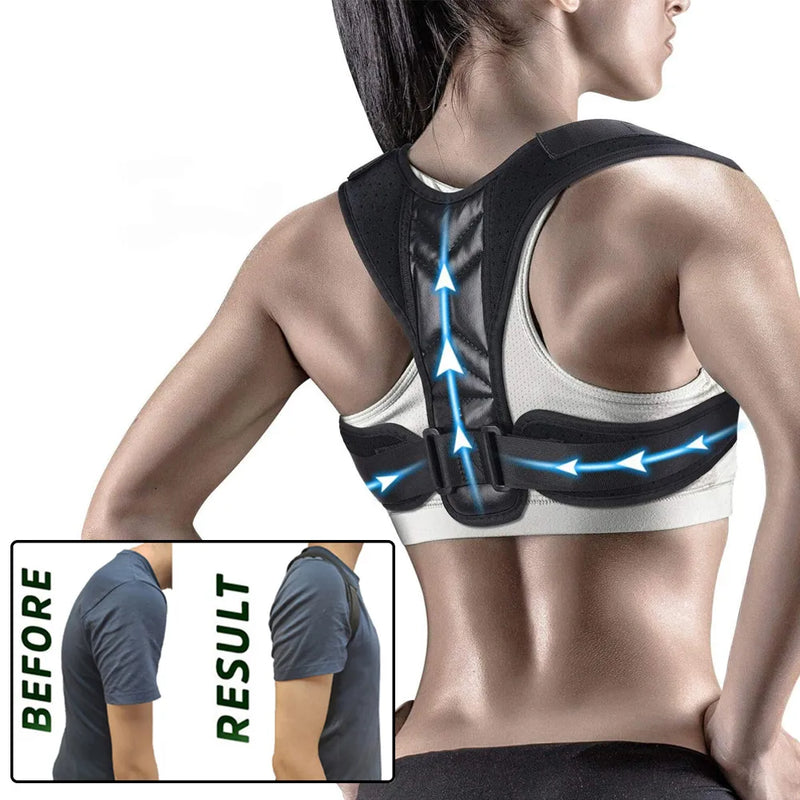 Adjustable Posture Corrector